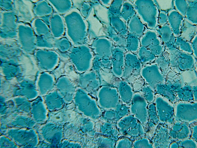 Микроскоп Bresser Biolux LCD 40x-1600x, 2Mp - Фото 34