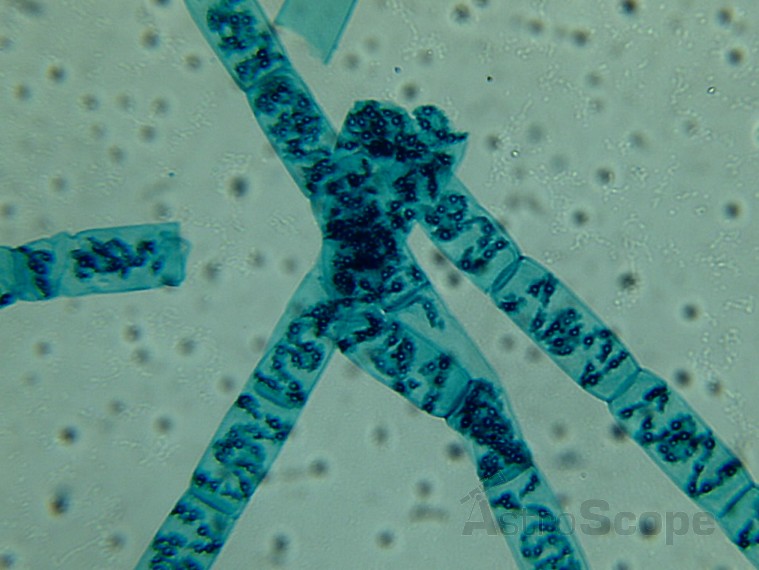 Микроскоп Bresser Biolux LCD 40x-1600x, 2Mp - Фото 35